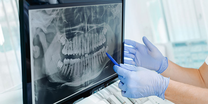 Home 1 Wynberg Dentistry Clinical and radiological diagnostics equipment at Wynberg Dentistry